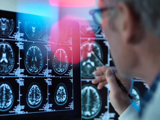 The Growing Importance of Expert Neurological Care in Modern Healthcare